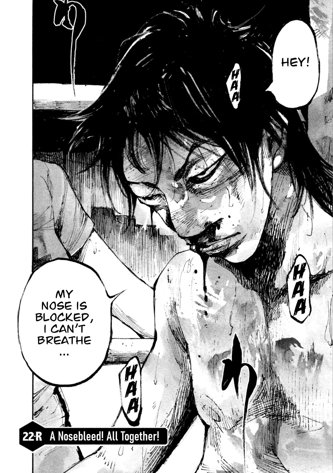 Black-Box Vol.5 Chapter 22: A Nosebleed! All Together! - Picture 2